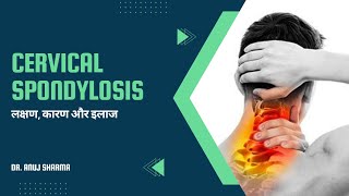 Cervical Spondylosis Treatment Causes Symptoms and Exercises  Cervical Spondylosis का सटीक इलाज [upl. by Lerraf]