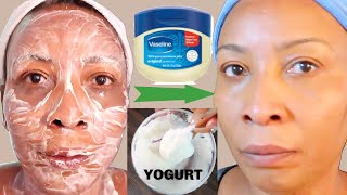 You Will Not Believe What This Vaseline Mask Did To My Skin🔥🔥 [upl. by Bak725]