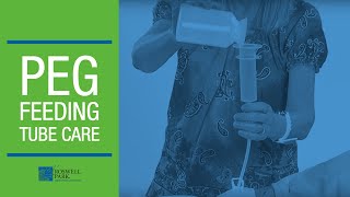 PEG Feeding Tube Care Instructions  Roswell Park Patient Education [upl. by Sihtam]