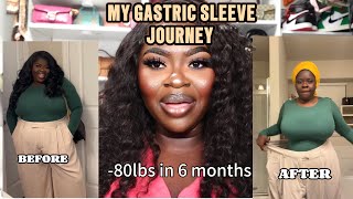 MY GASTRIC SLEEVE JOURNEY [upl. by Humpage]