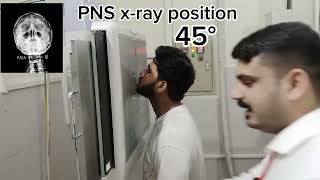 PNS xray position ParaNasal Sinus Digitaldoctor hospital mbbs dr xray [upl. by Iclehc]