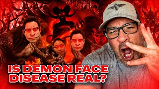 REAL Demon Face Syndrome RevealedShapeshifters Among Us You Will Not Believe This [upl. by Dviad598]