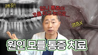 치과의사 생활하면서 처음 본 케이스입니다 대학병원에서도 치료 못한 미스테리한 통증 치료 [upl. by Augustin]