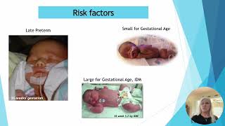 Neonatal Hypoglycemia [upl. by Enelhtac]