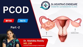 Myths and Facts Of PCOD  Part 2 By Dr Nishitha Reddy pcod pcodawareness [upl. by Abigael]