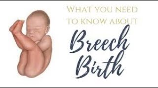 Breech presentation Causes complications and prevention  pregnancy breechpresentation [upl. by Larochelle]