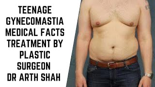 Teenage Gynecomastia Medical facts and Treatment options explained by Plastic Surgeon Dr Arth Shah [upl. by Kiraa]