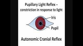 Pupillary Light Reflex  Cranial Nerves II amp III [upl. by Dressel475]