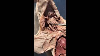 Fetal Pig Dissections 8 Salivary Glands Thymus Thyroid [upl. by Ebag]