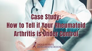 Case Study How to Tell if Your Rheumatoid Arthritis is Under Control [upl. by Laddie202]