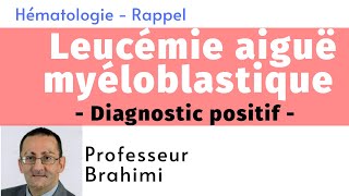 Leucémie Aiguë Myéloblastique Diagnostic positif [upl. by Tzong]