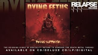 DYING FETUS  quotRevisionist Pastquot [upl. by Budde]