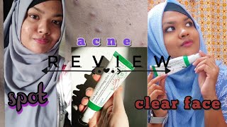 AXIY Y Dark spot correcting glow serum  review  acne ✅dark spot ✅honest review [upl. by Daffy]