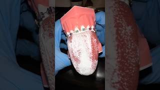 Dentist Reveals TOP 3 Reasons You Have BAD Breath 🤢🦷 [upl. by Humbert330]