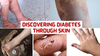 quotDiabetes Unveiled Decoding the 15 Skin Symptoms You Should Never Ignorequot [upl. by Llehsor]