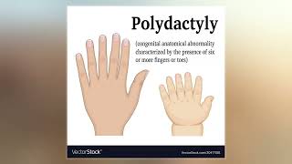 Polydactyly [upl. by Axel]