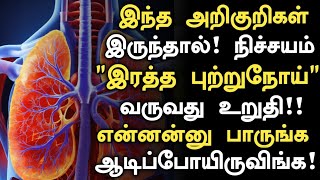 இந்த அறிகுறிகள் இருந்தால் இரத்த புற்றுநோய் வருவது உறுதிBlood Cancer Symptoms in Tamil Health Tips [upl. by Yelrahs]