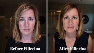 Fillerina Plumping System Review  BEFORE and AFTER [upl. by Savart]