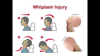 lecture 3 completion atlantoaxial  atlantooccipital joints   Hyoid bone [upl. by Eslehc]