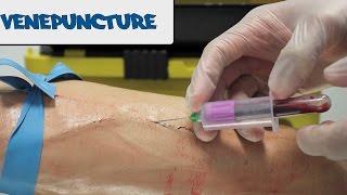 Venipuncture  How to take Blood  OSCE Guide old version  UKMLA  CPSA [upl. by Messere813]