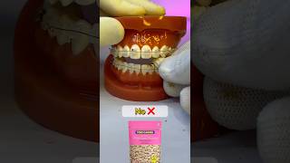 🥜🍪Teeth no or yes❓❓🤔🤔teeth health trending shorts dentist orthodontist [upl. by Atig]