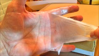 Hand Peel  Peeling from Skin [upl. by Noirred413]