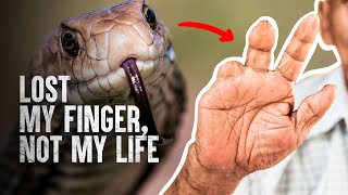 How to Survive The Most Dangerous Snake Bites  Part 2 [upl. by Zoe]