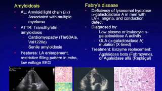 Medicine Today  Ep 9  Cardiomyopathies [upl. by Nasya]