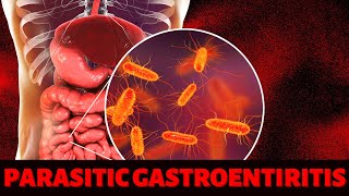 PARASITIC GASTROENTIRITIS [upl. by Willey]