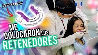 MI TRATAMIENTO DE ODONTOLOGIA 2  ME COLOCARON LOS RETENEDORES Y QUEDE HABLANDO RARO [upl. by Valeta372]