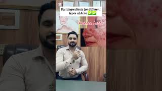 Best Ingredients for Acne ✅️ drasifyasin acnetreatment acnetypes acneonface youtubeshorts [upl. by Lorinda]