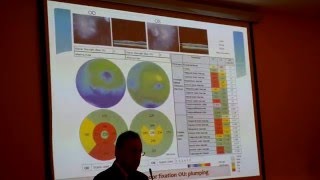 Dr Jeffrey N Weiss quotBone Marrow Fraction Treatment Of The Optic Nerve Disease CMEquot [upl. by Lanor]