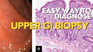 quotMastering Endoscopic Biopsy in Upper GIT A CaseBased Approachquot [upl. by Katey]