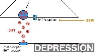 Major Depression and SSRIsSNRIs [upl. by Caravette]