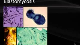 42 Systemic Mycoses [upl. by Suirtimed]