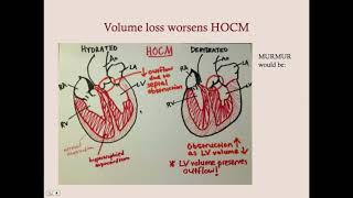 Cardiomyopathies  CRASH Medical Review Series [upl. by Hermina848]