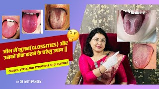 जीभ में सूजनGLOSSITIES और उसको ठीक करने के घरेलु उपाय [upl. by Maye]