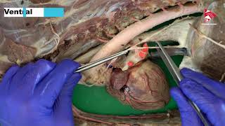 Anatomy of the Vagus and Sympathetic Trunk inside the thoracic cavity [upl. by Thunell371]