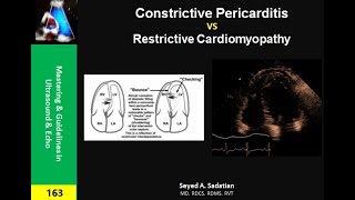 Constrictive Pericarditis vs Restrictive Cardiomyopathy [upl. by Eek59]