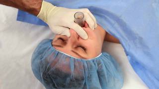 NuMask in Anesthesiology IntraOral Mask IOM®  Oropharyngeal Airway OPA Training Video [upl. by Alwin]