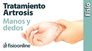 Tratamiento de fisioterapia para la artrosis de manos y dedos [upl. by Redmond875]