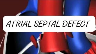 ATRIAL SEPTAL DEFECT CONGENITAL HEART DISEASE [upl. by Anaik590]