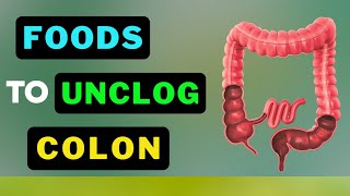 From Clogged to Clean Top Secret Colon Detoxifiers Revealed [upl. by Bekki]