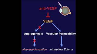 AntiVEGF for the treatment of Retinal Diseases  ANCHOR MARINA BRAVO CRUISE DRCR Protocol I [upl. by Ehcadroj365]