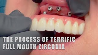 The Process of Terrific Full Mouth Zirconia [upl. by Isabea770]