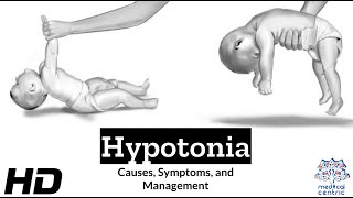 Hypotonia Explained What You Need to Know [upl. by Atnohs]