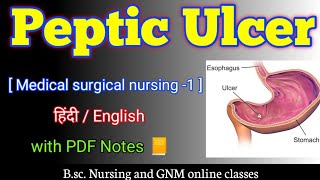 Peptic ulcers bsc nursing 2nd year  Peptic ulcer in hindi  Peptic ulcer medical surgical nursing [upl. by Niamreg229]