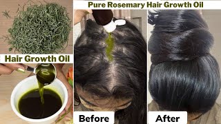 I used👆🏼this Rosemary Hair Growth Oil on Thinning Hair amp Bald ScalpGot 10 times Thick Hair Growth [upl. by Gun]