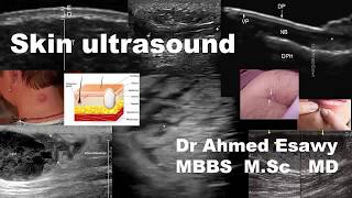 Skin Ultrasound [upl. by Utter438]