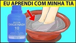 VEJA COMO ACABAR COM A MICOSE DAS UNHAS COM ESTES 2 PODEROSOS REMÉDIOS CASEIROS [upl. by Yorel]